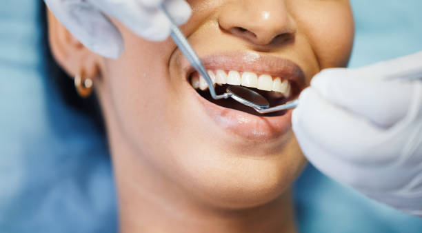 Best Emergency Gum Pain Relief  in Dahlone, GA